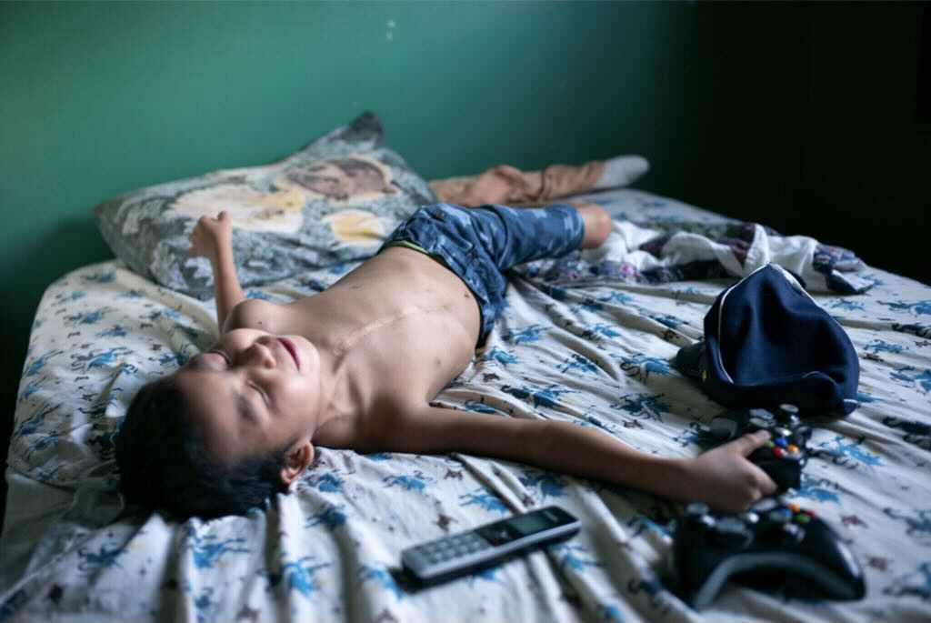 Fort McKay First Nation band member Dez in his bedroom in Fort McKay AB, on August 12th, 2015. At seven years old, Dez had already endured two open heart surgeries after being born with a heart defect. Local doctors and family members of Dez believe that industrial pollution could be the cause of his condition. Image by Ian Willms.